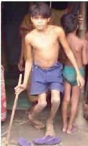 ডাল বীজের পুষ্টিমান